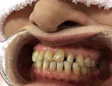 症例